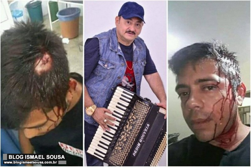 Sanfoneiro acusa Dedim Gouveia de agressÃ£o durante show