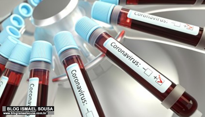 Taxa de letalidade pelo Covid-19 Ã© de 2,9% no RN