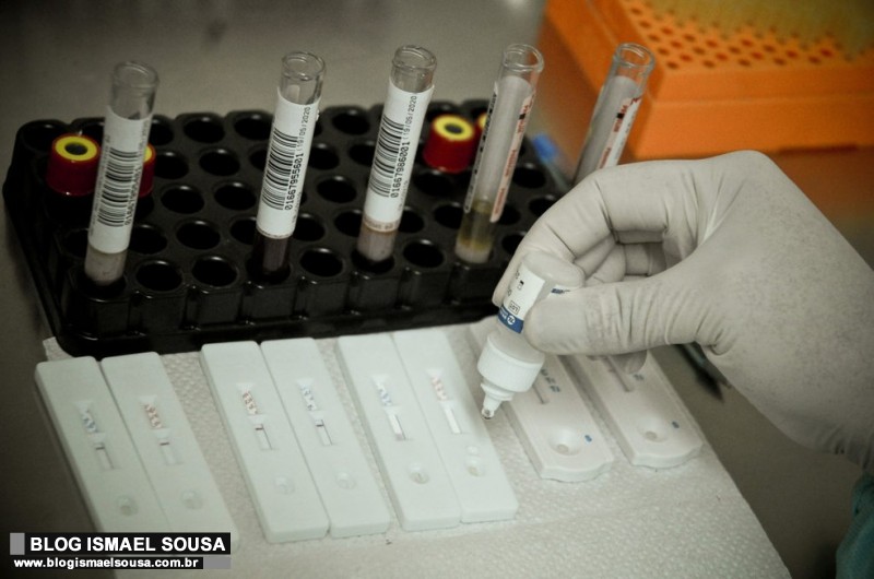RN comeÃ§a a descer do platÃ´ de casos coronavÃ­rus, afirma Sesap