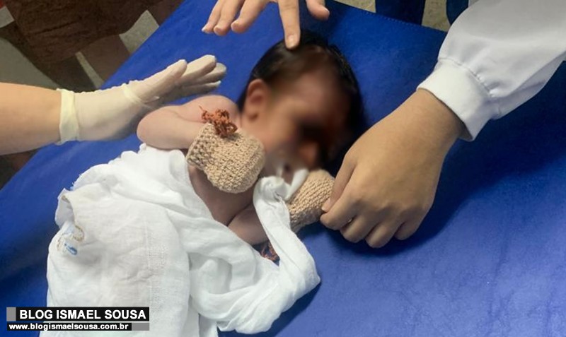 Policial Militar salva bebê de 38 dias engasgado em Mossoró