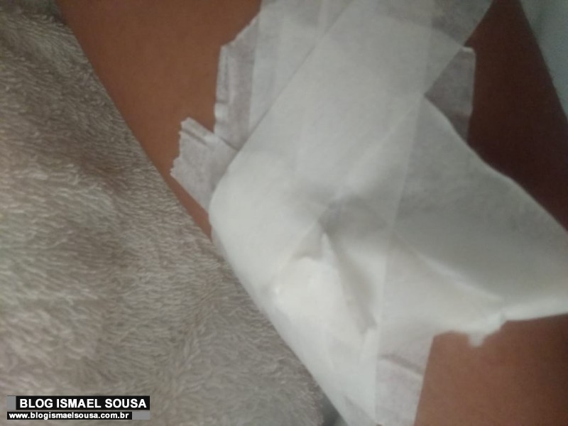Por falta de esparadrapo, fita gomada Ã© usada para fazer curativos no Hospital TarcÃ­sio Maia