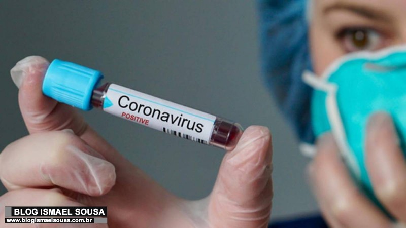 A farsa da vacina cubana contra o CoronavÃ­rus