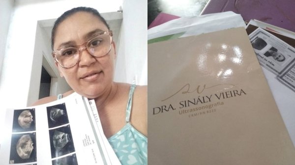 Doméstica afirma que teve que vender moto para custear cirurgia em Mossoró