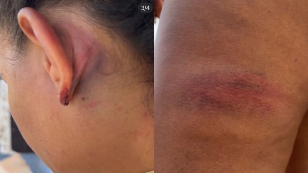 Governo afasta policiais e abre investigação após OAB/RN denunciar agressão a advogada em Serra do Mel